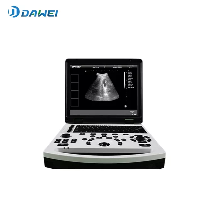 01-sistema-de-diagnostico-ultrasonico-portatil-bw.webp
