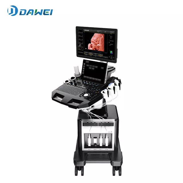 03-escandor-de-ultrasound-crolley-4d-para-la-pregencia.webp